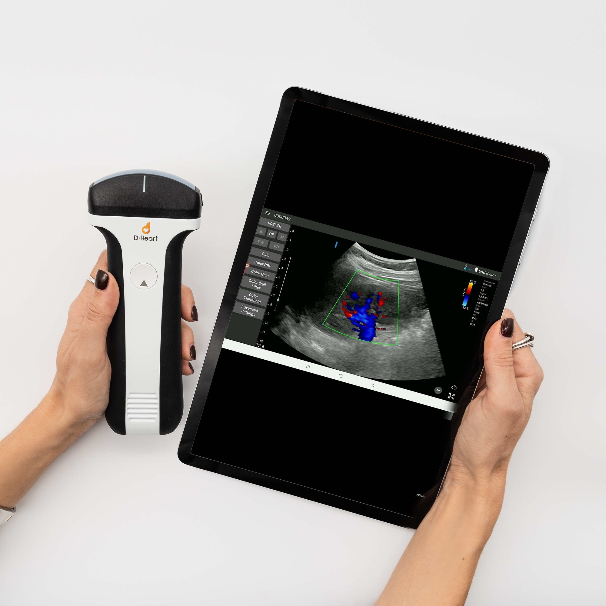 D-HEART SCANNER CONVEX
