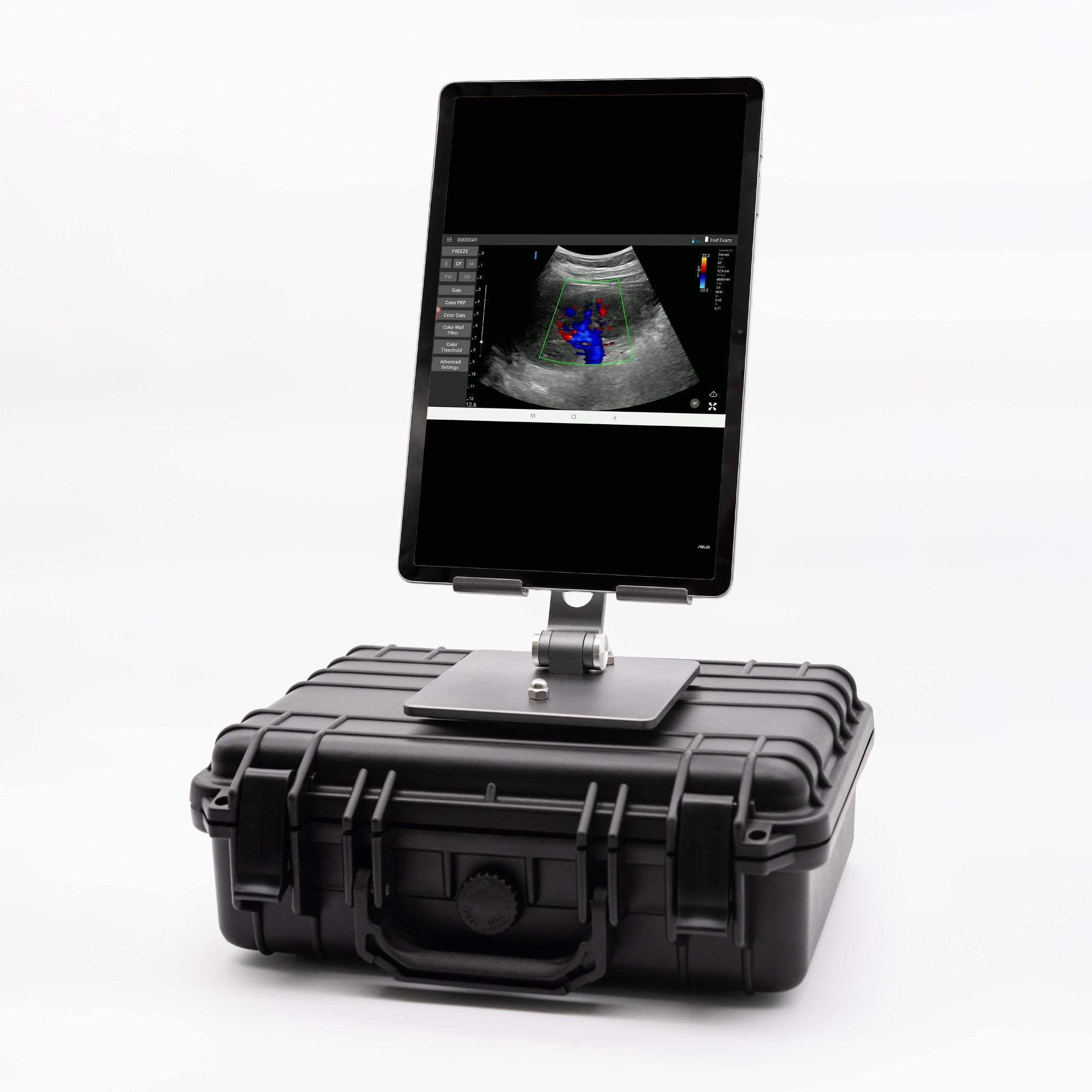 D-HEART SCANNER CONVEX